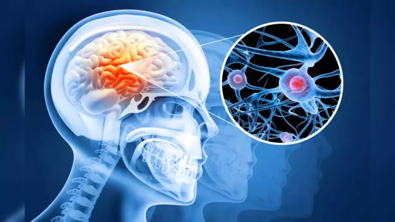 Image Source : Public Domain