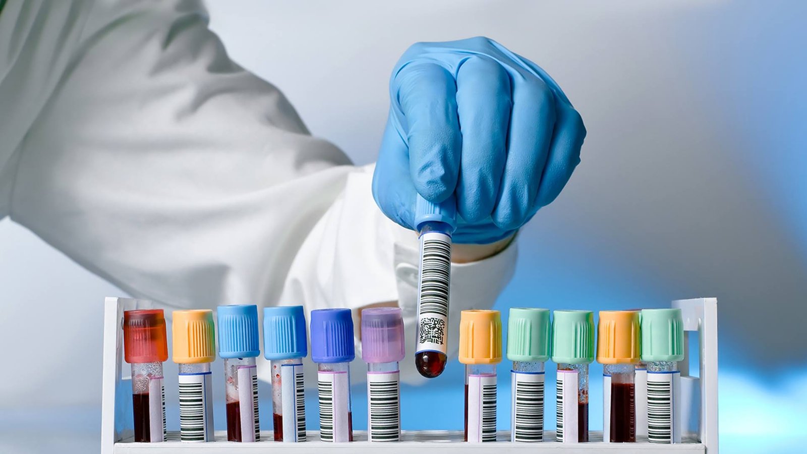 Image Source : Public Domain