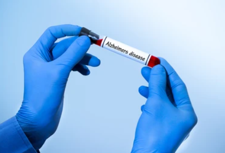 image credit- shutterstock