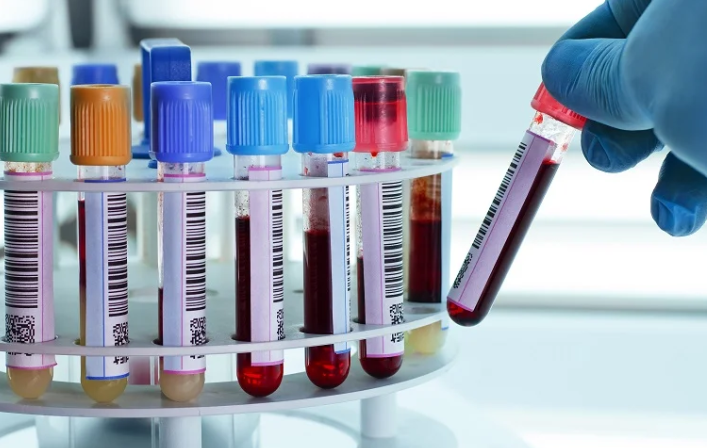 image credit- shutterstock