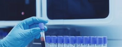 image credit- shutterstock