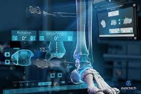 Image Source : Public Domain