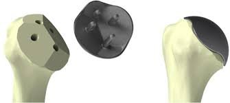 Image Source : Public Domain