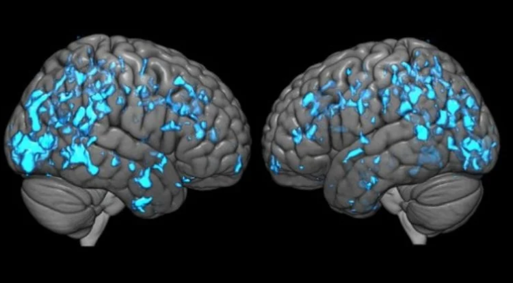 image credit- shutterstock