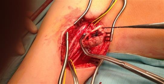 Image Source : Public Domain