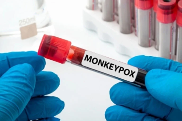 image credit- shutterstock