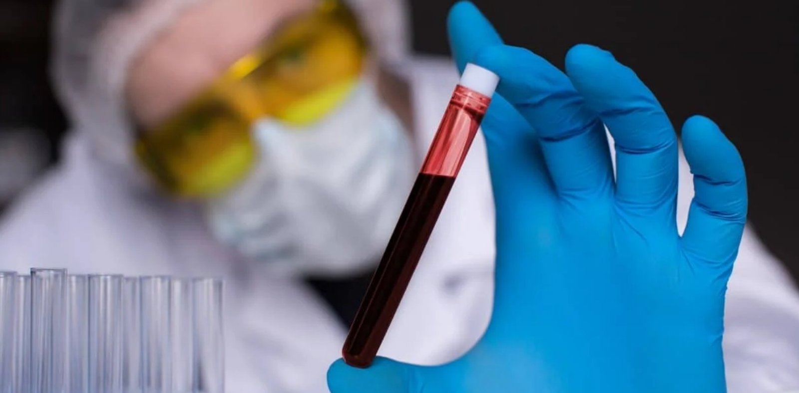 image credit- shutterstock