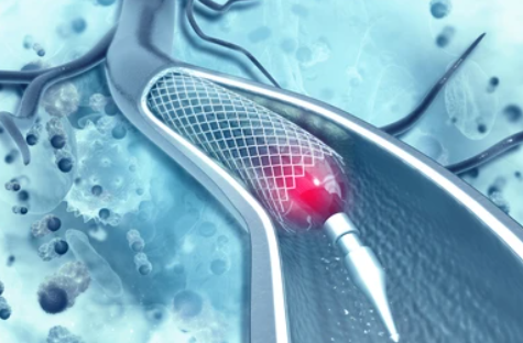 image credit- shutterstock