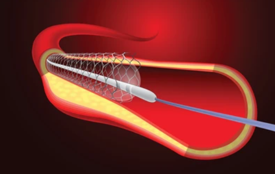 image credit- shutterstock