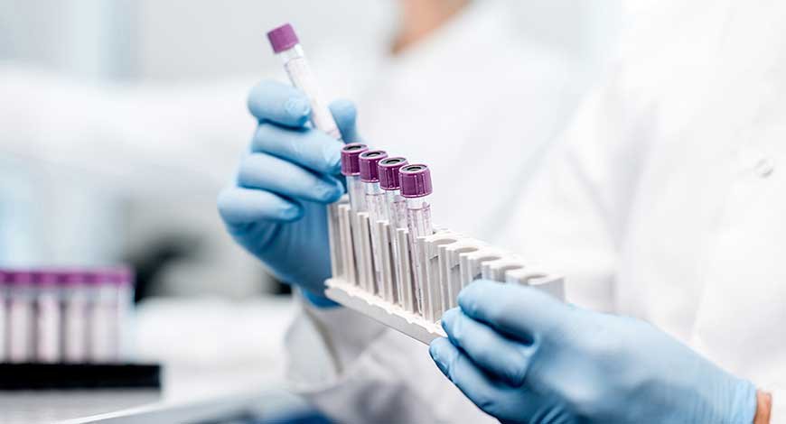 Image Source : Public Domain