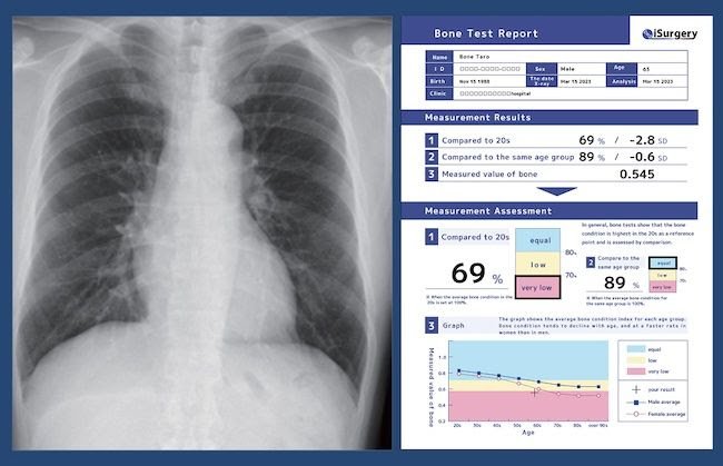 Image of analysis and inspection by AI medical device
